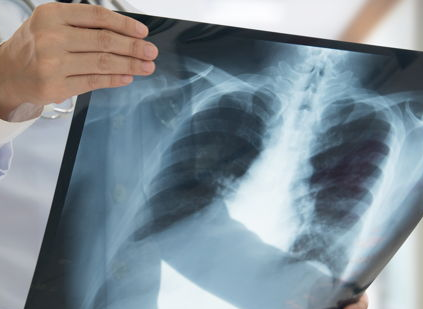 imagenologia
