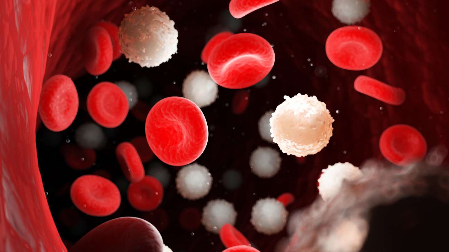 Día Mundial de Concienciación sobre la Leucemia Mieloblástica Aguda (LMA)