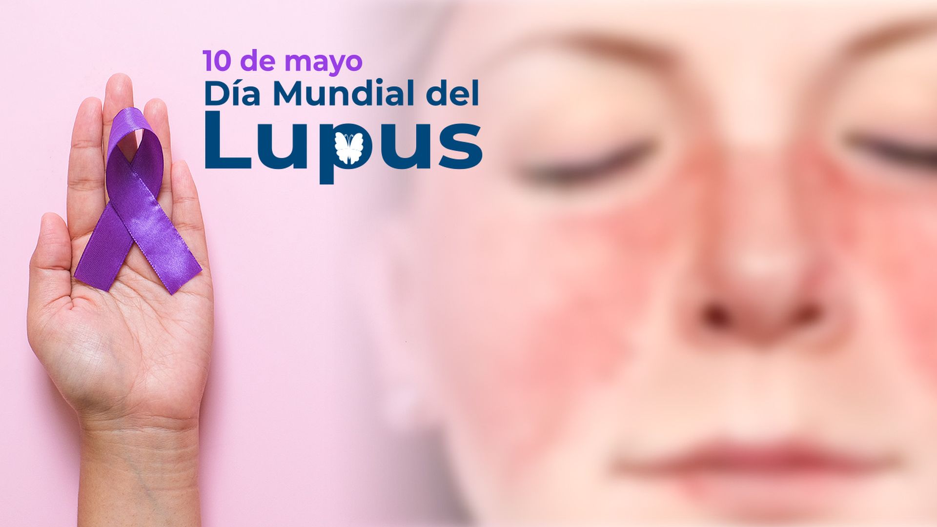 La atención multdisciplinaria del LUPUS en el Clínicas.