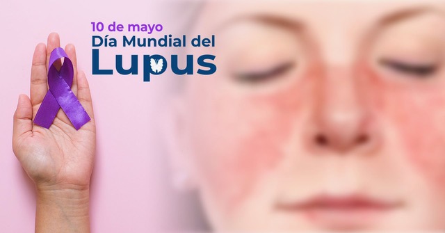 10 de mayo: Día Mundial del Lupus